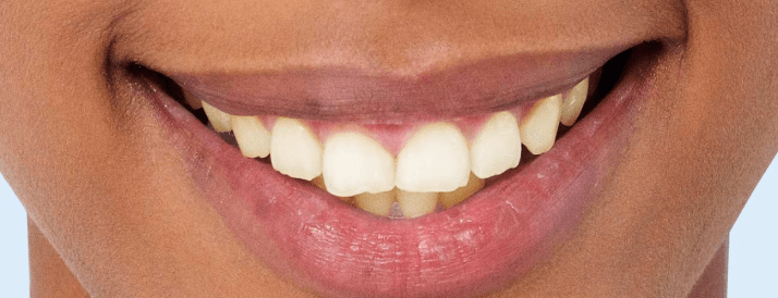 Rectangle-5747-1-min