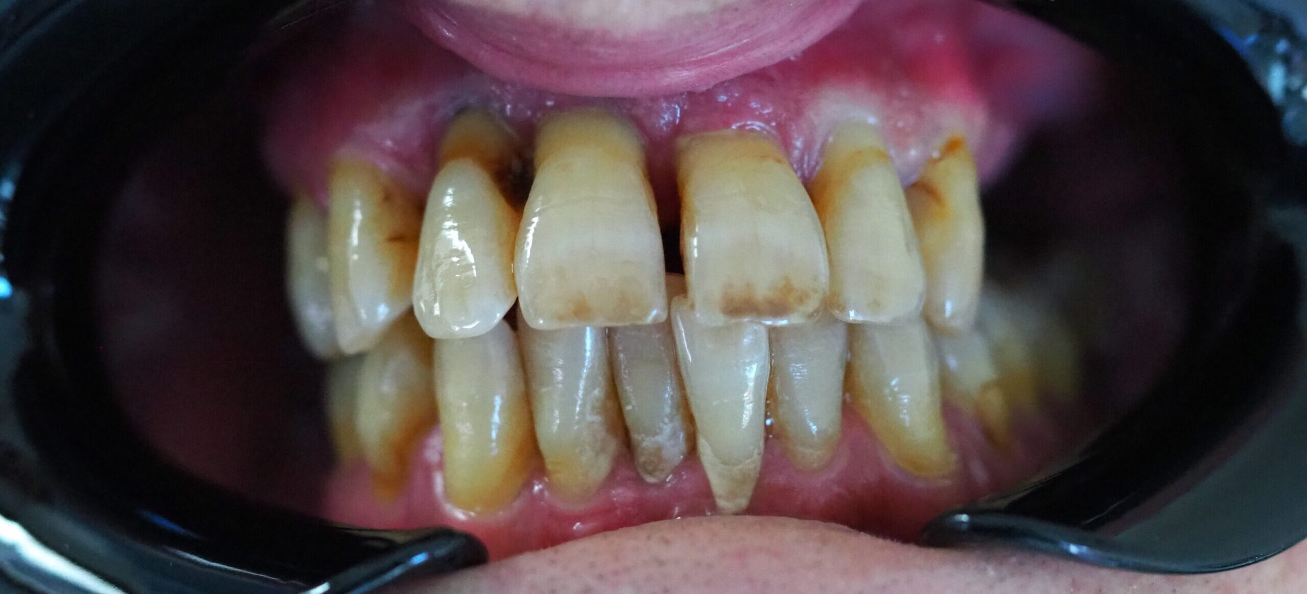 OLYMPUS DIGITAL CAMERA OLYMPUS DIGITAL CAMERA