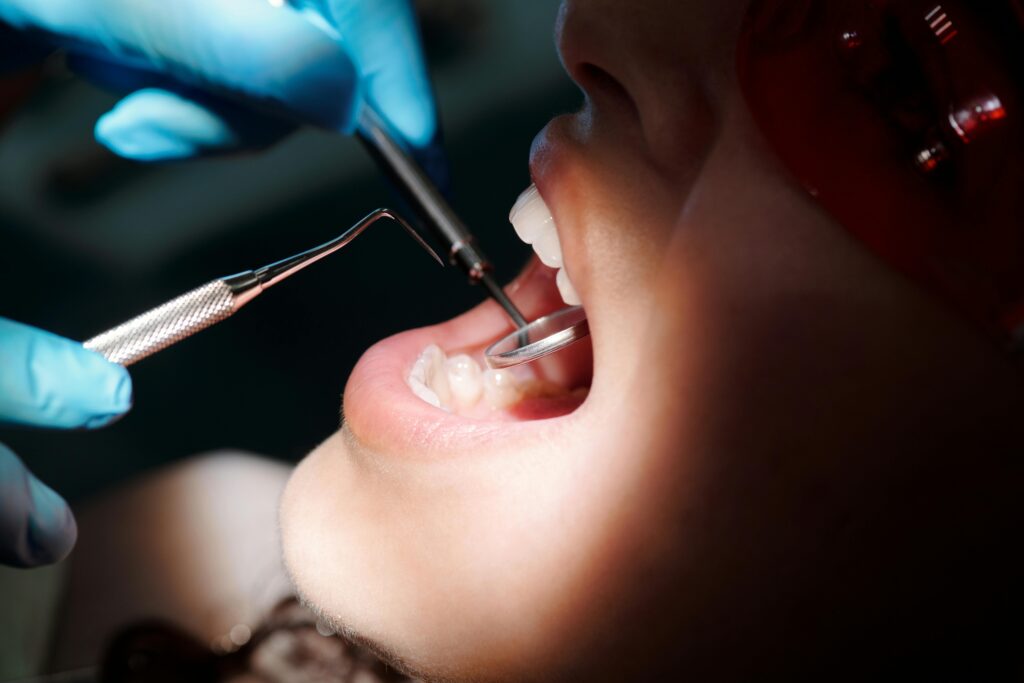 tooth filling treatment