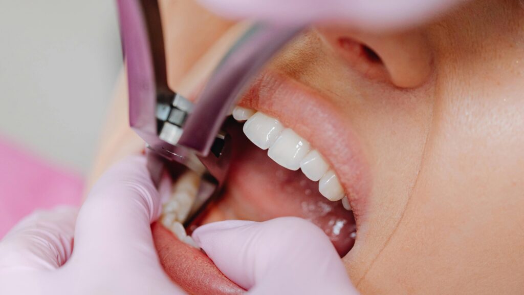 fixed dental prosthetics